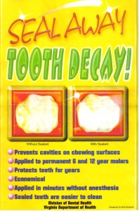 dental-sealants-seal-away-tooth-decay-poster (1)